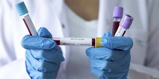 Antikor furyası kafa karıştırıyor