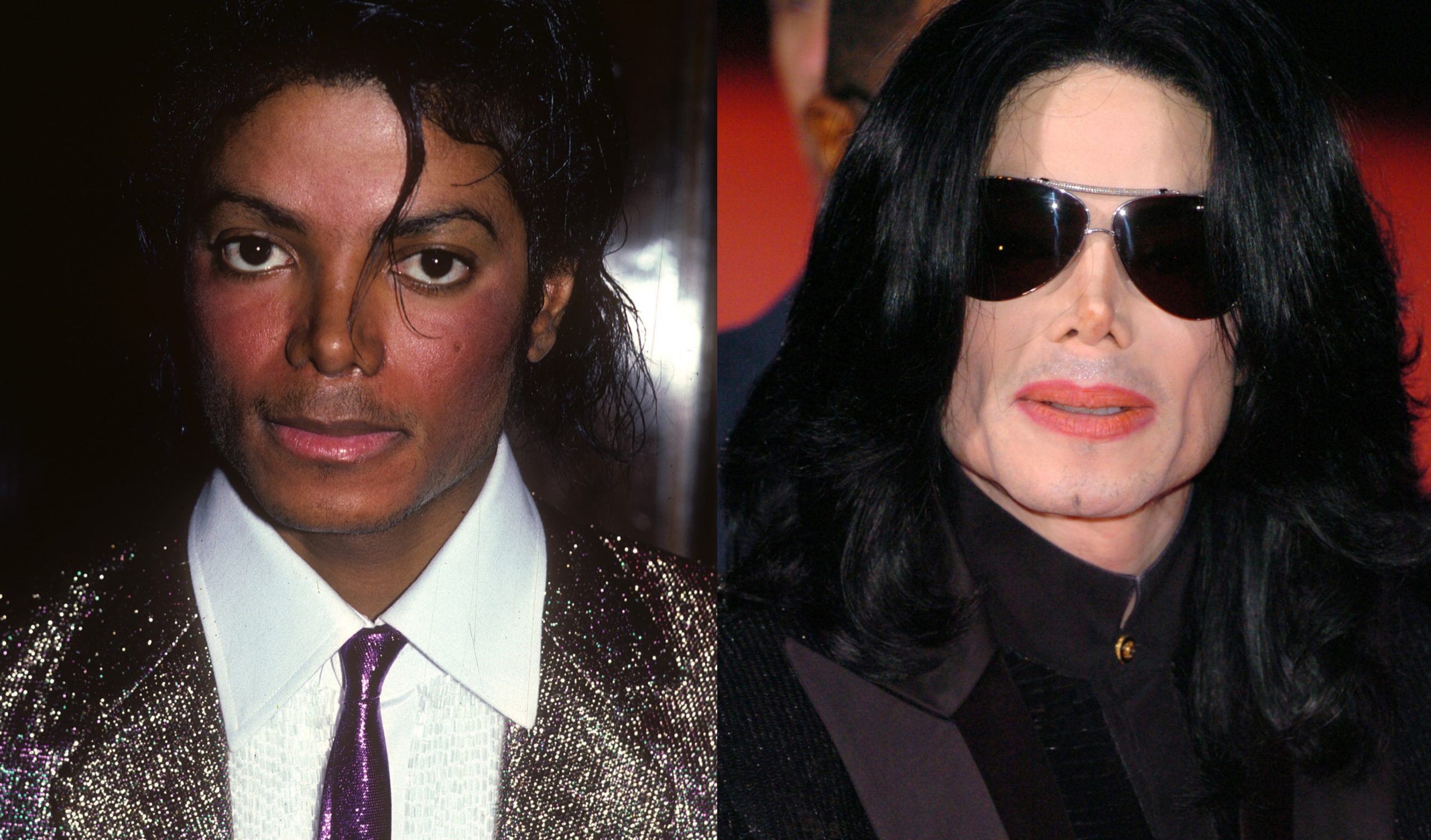 Michael Jackson kimdir? Neden öldü? Kaç yaşında öldü? Michael Jackson kimdir? Neden öldü? Kaç yaşında öldü?